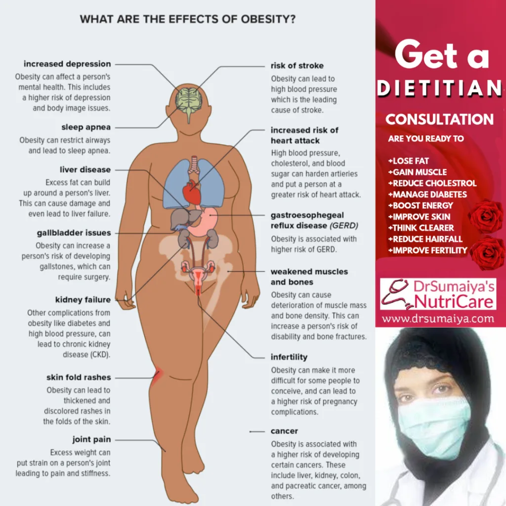 Obesity is a Disease