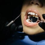 A close-up view of a child undergoing a dental examination with tools in their mouth.